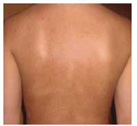 Back after Back after